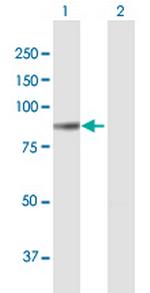 COL8A1 Antibody in Western Blot (WB)