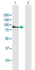 COMP Antibody in Western Blot (WB)