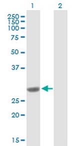 COMT Antibody in Western Blot (WB)