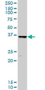 COMT Antibody in Western Blot (WB)