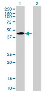 CPA1 Antibody in Western Blot (WB)