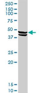 CPA1 Antibody in Western Blot (WB)