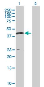 CPA1 Antibody in Western Blot (WB)