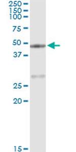 CPA1 Antibody in Immunoprecipitation (IP)