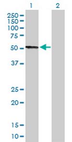 CPB2 Antibody in Western Blot (WB)