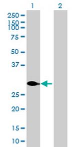 ATF2 Antibody in Western Blot (WB)