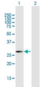 ATF2 Antibody in Western Blot (WB)