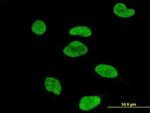 ATF2 Antibody in Immunocytochemistry (ICC/IF)