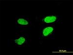 ATF2 Antibody in Immunocytochemistry (ICC/IF)