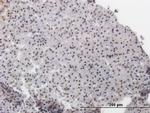 ATF2 Antibody in Immunohistochemistry (Paraffin) (IHC (P))