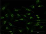 ATF2 Antibody in Immunocytochemistry (ICC/IF)