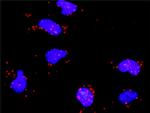 ATF2 Antibody in Proximity Ligation Assay (PLA) (PLA)