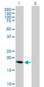 CRH Antibody in Western Blot (WB)