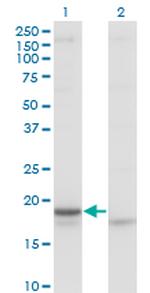 CRH Antibody in Western Blot (WB)