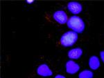 CRKL Antibody in Proximity Ligation Assay (PLA) (PLA)