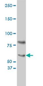 CRY1 Antibody in Western Blot (WB)