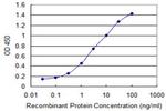 CRYGC Antibody in ELISA (ELISA)