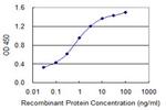 CRYGC Antibody in ELISA (ELISA)