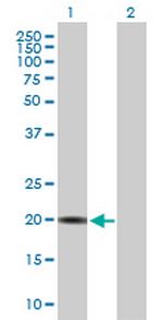 CRYGS Antibody in Western Blot (WB)