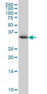 CRYM Antibody in Western Blot (WB)