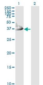 CRYM Antibody in Western Blot (WB)