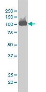 CSE1L Antibody in Western Blot (WB)