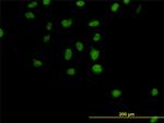 CSE1L Antibody in Immunocytochemistry (ICC/IF)