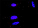 CSF1R Antibody in Proximity Ligation Assay (PLA) (PLA)