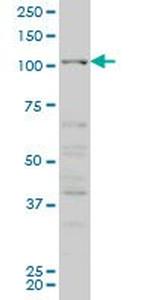 CSF1R Antibody in Western Blot (WB)