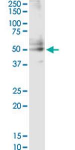 CSF2 Antibody in Western Blot (WB)