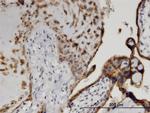 CSNK1D Antibody in Immunohistochemistry (Paraffin) (IHC (P))