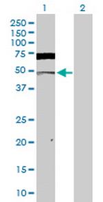 CSNK2A1 Antibody in Western Blot (WB)