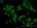 CSNK2A1 Antibody in Immunocytochemistry (ICC/IF)