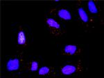 CSNK2A1 Antibody in Proximity Ligation Assay (PLA) (PLA)