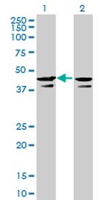 CSNK2A1 Antibody in Western Blot (WB)