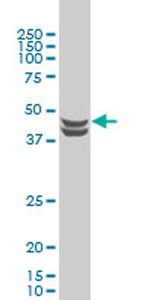 CSNK2A1 Antibody in Western Blot (WB)