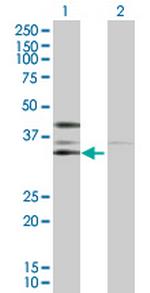 CSNK2A2 Antibody in Western Blot (WB)