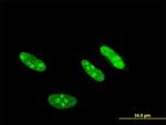 CSNK2A2 Antibody in Immunocytochemistry (ICC/IF)