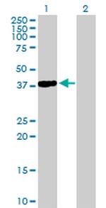 NKX2-5 Antibody in Western Blot (WB)