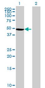 CTBS Antibody in Western Blot (WB)