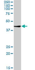 CTBS Antibody in Western Blot (WB)