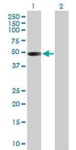 CTBS Antibody in Western Blot (WB)