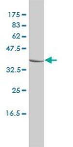 CTBS Antibody in Western Blot (WB)