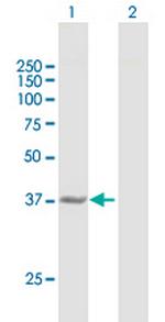 CTH Antibody in Western Blot (WB)