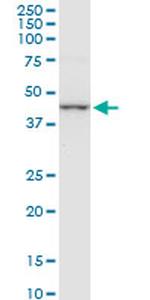 CTH Antibody in Western Blot (WB)