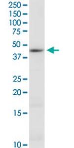 CTH Antibody in Western Blot (WB)