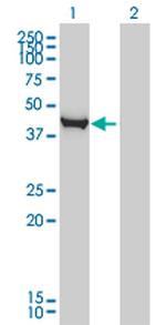 CTH Antibody in Western Blot (WB)