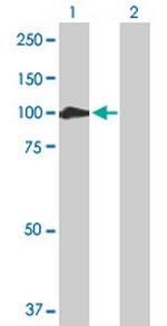 CTNNA2 Antibody in Western Blot (WB)