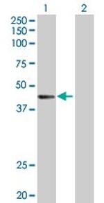 CTNS Antibody in Western Blot (WB)