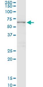 CTNS Antibody in Western Blot (WB)